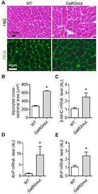 Galanin Regulates Myocardial Mitochondrial ROS Homeostasis and Hypertrophic Remodeling Through GalR2